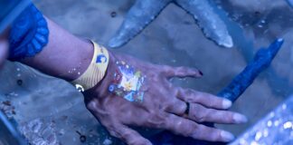 Si Kecil Luka? Ini Tips Merawat Luka Pada Anak